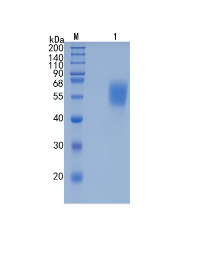 Active Recombinant Human Cortisol Binding Globulin / SERPINA6 Protein