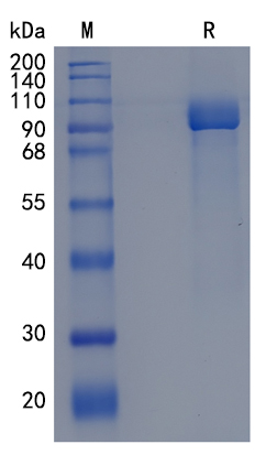 Active Recombinant Human CD10 / Neprilysin / MME Protein