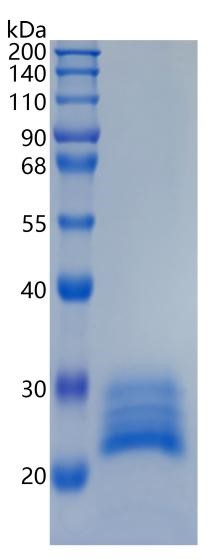 Active Recombinant Mouse Interleukin-6 / IL-6 Protein