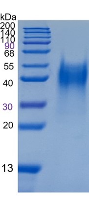 Active Recombinant Mouse LIF / Leukemia Inhibitory Factor Protein