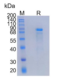 Active Recombinant Mouse E-Cadherin / CDH1 Protein