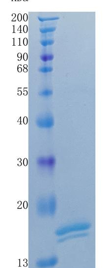 Active Recombinant Human G-CSF / CSF3 Protein