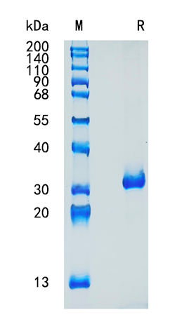 Active Recombinant Human VSIG8 / V-set and immunoglobulin domain-containing protein 8 Protein