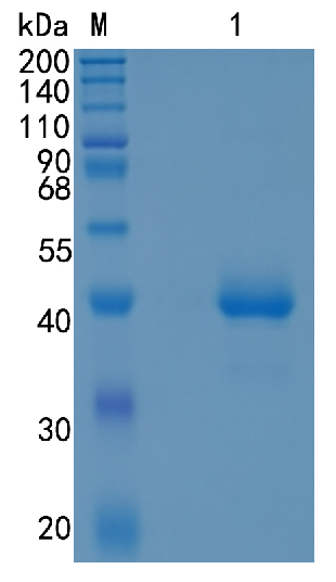 Active Recombinant Mouse CCL1 / I-309 / TCA-3 Protein