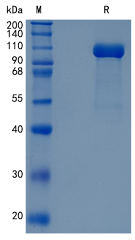 Active Recombinant Human GAA / Alpha-glucosidase / Acid Maltase Protein