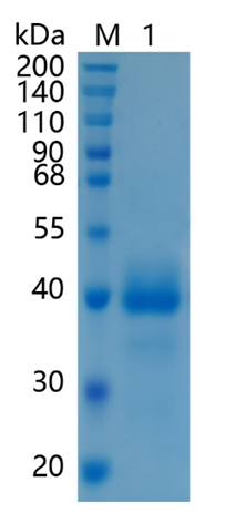 Active Recombinant Mouse Cathepsin B / CTSB Protein