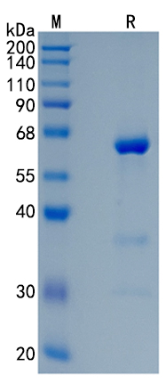 Active Recombinant Human Cathepsin A / Protective Protein / CTSA Protein