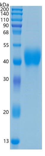 Active Recombinant Human TFPI / LACI / Extrinsic Pathway Inhibitor Protein