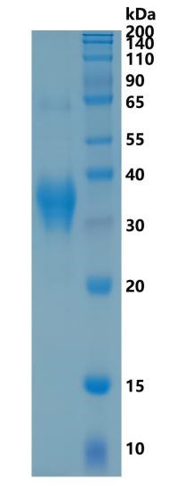 Active Recombinant Human Clusterin alpha chain / CLU Protein