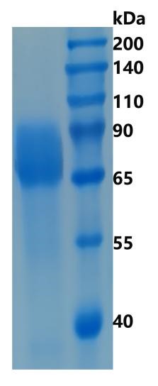 Active Recombinant Human Growth Hormone Receptor / GHR Protein