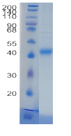 Active Recombinant Human HAPLN1 / CRTL1 Protein