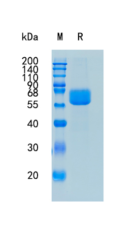 Active Recombinant Human PSG1 / Pregnancy-specific beta-1-glycoprotein 1 Protein