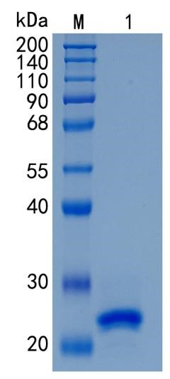 Active Recombinant Mouse Lipocalin-2 / NGAL / LCN2 Protein