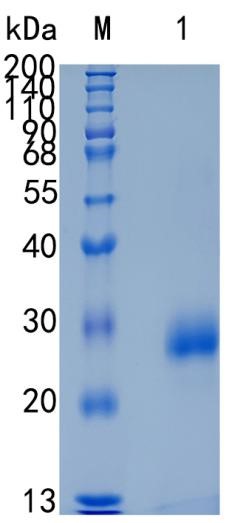 Active Recombinant Mouse TIMP1 / Tissue Inhibitor of Metalloproteinases-1 Protein