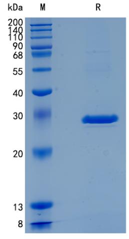 Active Recombinant Mouse Serum Amyloid P Component / SAP / APCS Protein