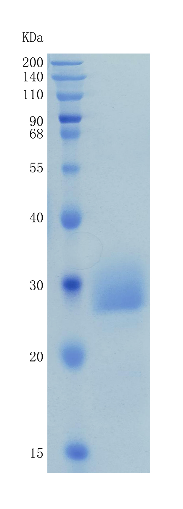 Active Recombinant Human CD32a / FCGR2A / Fc gamma RIIA Protein