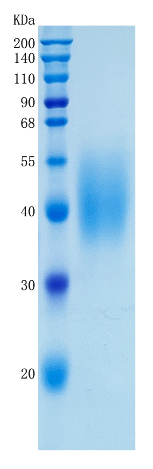 Active Recombinant Human FCER1A / Fc epsilon RI alpha Protein