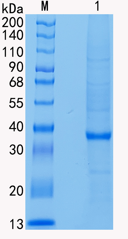 Active Recombinant Human ACP5 / TRAP / Tartrate-resistant Acid Phosphatase Protein