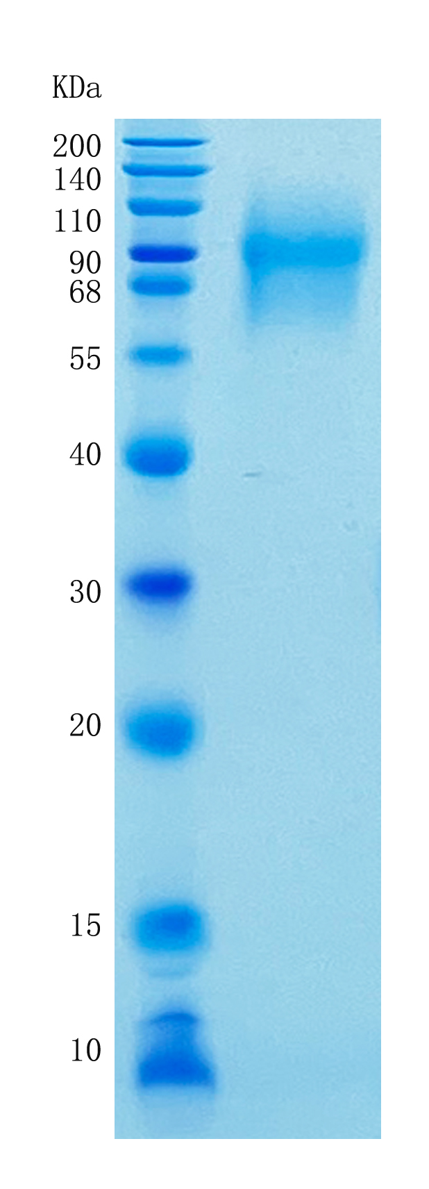 Active Recombinant Human CEACAM1 / CD66a Protein