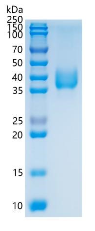 Active Recombinant Human Tissue Factor / CD142 / F3 Protein