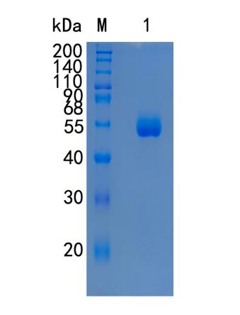 Active Recombinant Human Carboxypeptidase M / CPM Protein