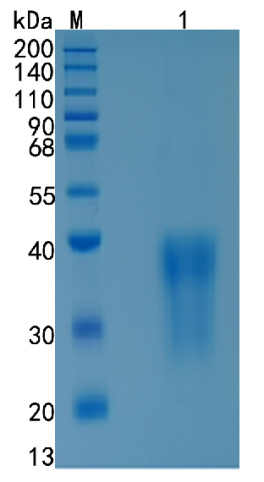 Active Recombinant Rat CCL2 / MCP-1 Protein