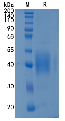 Active Recombinant Human IFN-gamma R1 / CD119 Protein