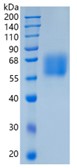 Active Recombinant Human CD116 / GM-CSFR alpha Protein