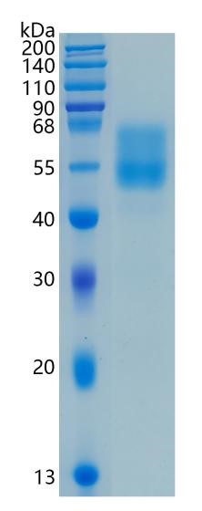 Active Recombinant Human MUC1 / Mucin-1 / CD227 Protein