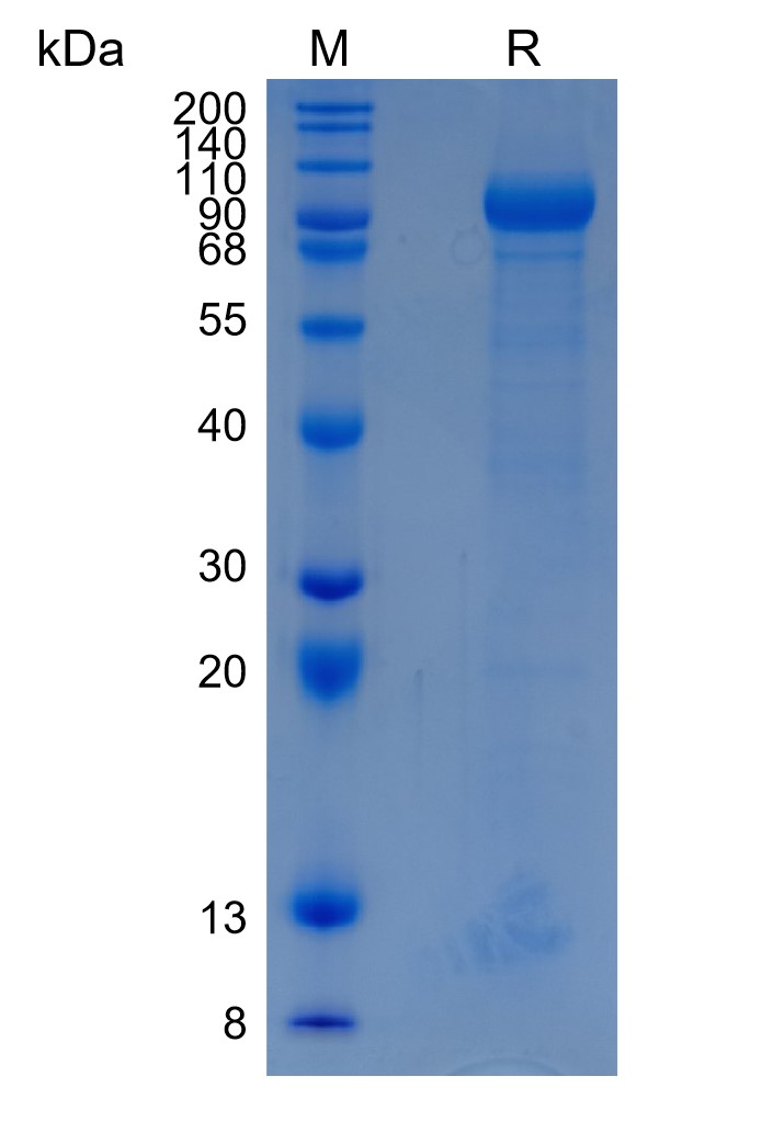 Active Recombinant Human GLB1 / Beta-galactosidase Protein