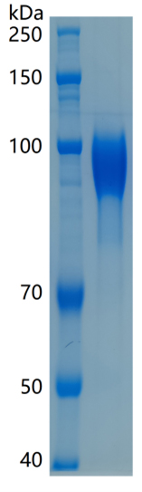 Active Recombinant Human CD31 / PECAM-1 Protein
