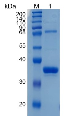 Active Recombinant Human ABO / B-Galactosaminyltransferase Protein