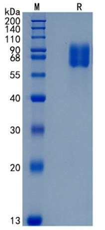 Active Recombinant Human IFNAR1 / Interferon alpha / beta Receptor 1 Protein