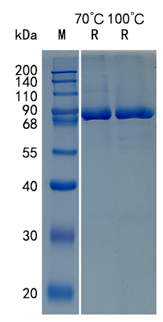 Active Recombinant Human BPI / Bactericidal Permeability-increasing Protein Protein