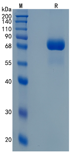 Active Recombinant Human SMPD1 / Acid Sphingomyelinase Protein
