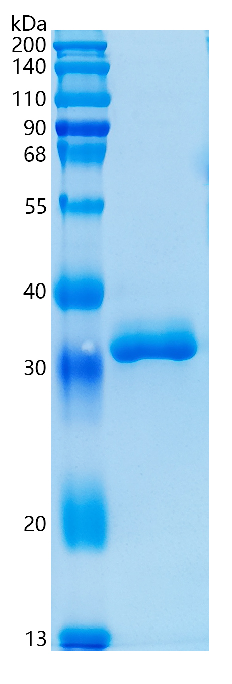Active Recombinant Human IGFBP-2 / IGF-binding protein 2 Protein