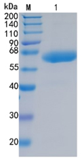 Active Recombinant Human LBP / Lipopolysaccharide-binding Protein Protein