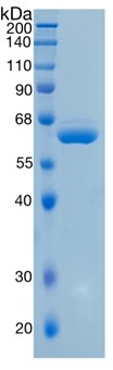 Active Recombinant Human EPO Receptor / CD123 Protein