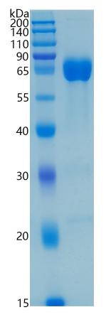 Active Recombinant Human CD33 / Siglec-3 Protein