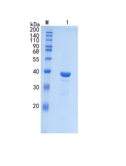 Active Recombinant Human Pepsinogen II / PGC Protein
