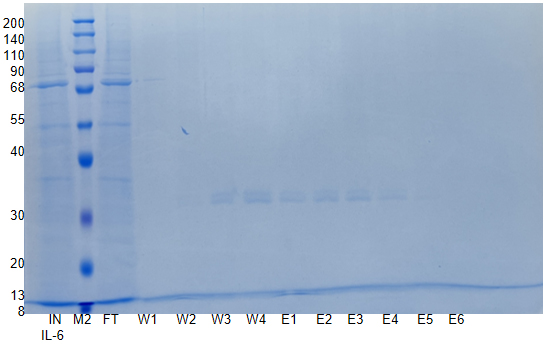 Active Recombinant Human Kallikrein 2 / KLK2 Protein
