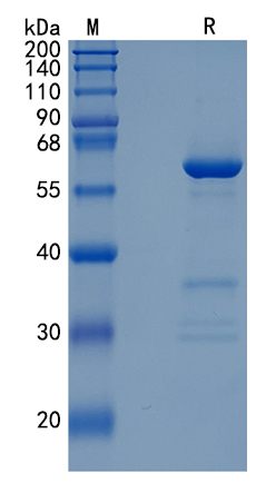 Active Recombinant Human CD73 / NT5E / Ecto-5′-nucleotidase Protein