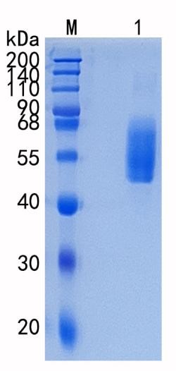 Active Recombinant Human CD204 / MSR1 / Macrophage Scavenger Receptor Protein