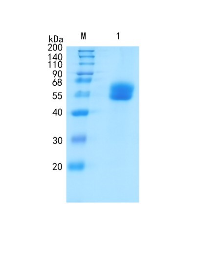 Active Recombinant Mouse IL-6R alpha / CD126 Protein