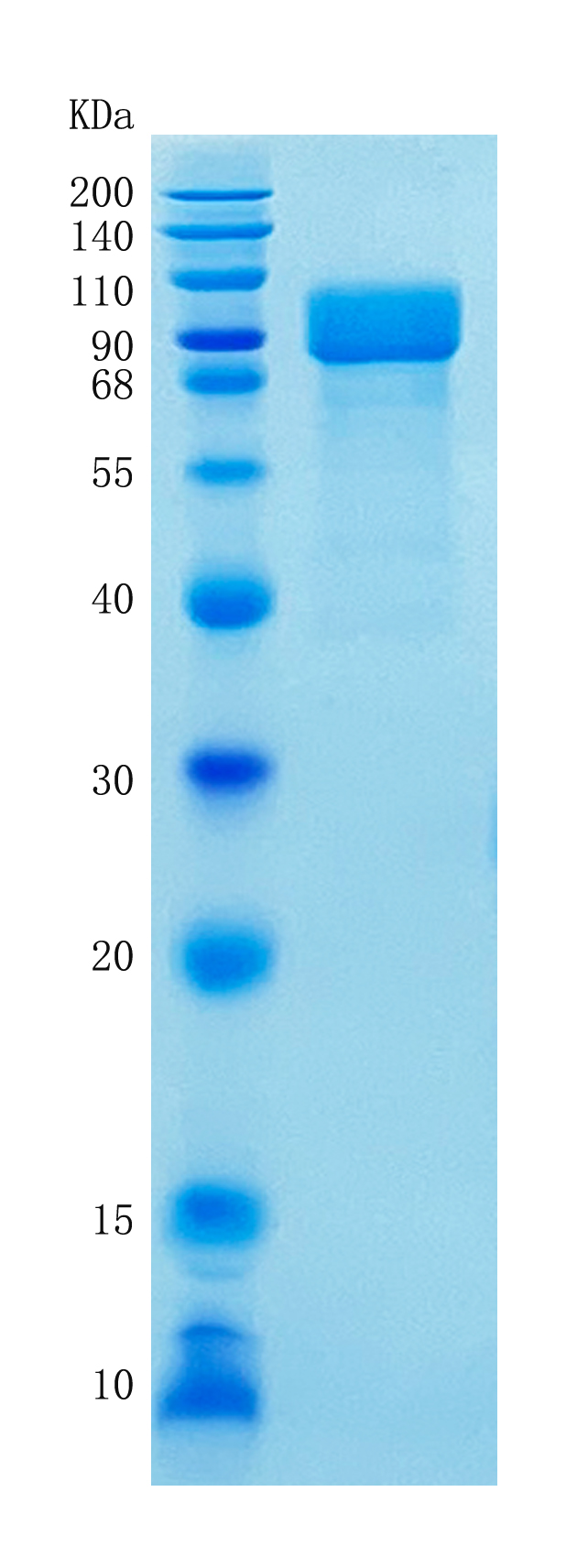 Active Recombinant Human Iduronate 2-Sulfatase / IDS Protein