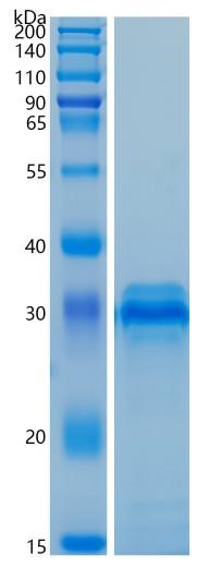 Active Recombinant Human IGFBP-4 / IGF-binding protein 4 Protein