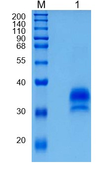 Active Recombinant Human IGFBP-6 / IGF-binding protein 6 Protein