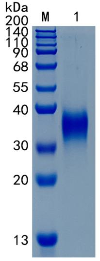 Active Recombinant Human IGFBP-5 / IGF-binding protein 5 Protein