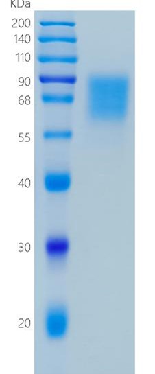 Active Recombinant Human GC-C / GUCY2C / Guanylyl Cyclase C Protein