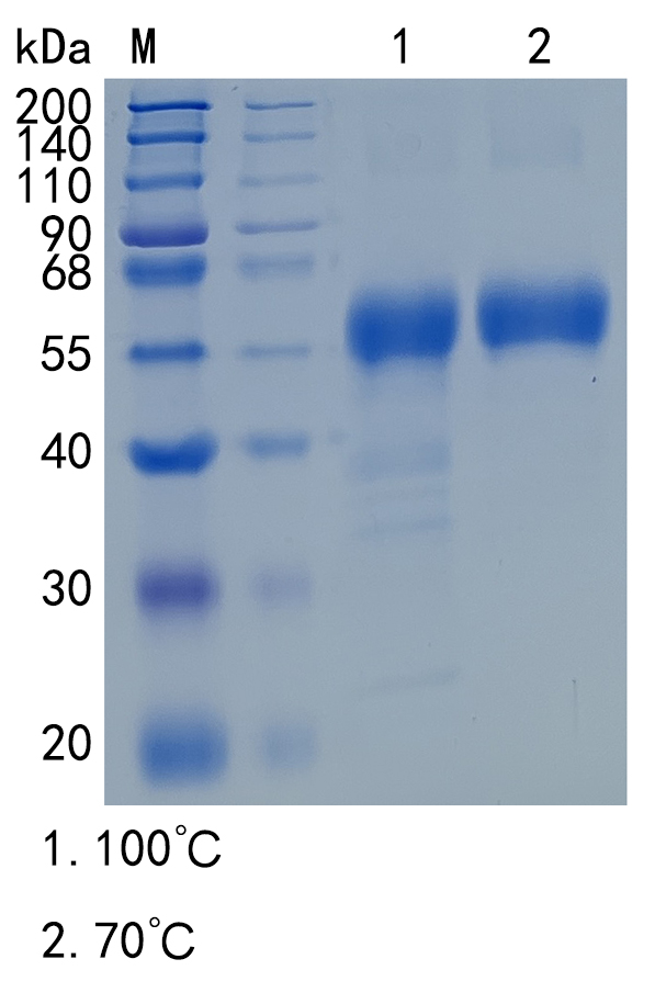 Active Recombinant Mouse Fas / CD95 / TNFRSF6 Protein